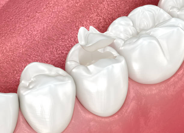 Best Tooth Extraction  in Milam, TX